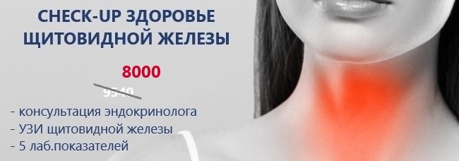 CHECK-UP здоровье щитовидной железы